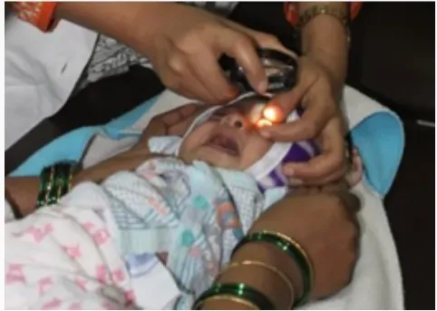 Paediatric Ophthalmogy Clinic service image