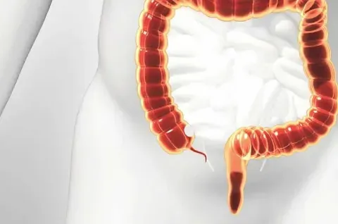 Appendix Treatment Doctor in Baner, Balewadi, Pune service image