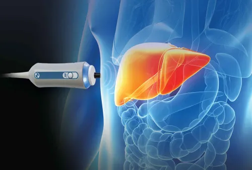 Fibroscan Testing in Baner, Balewadi, Pune service image