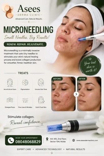 Microneedling service image