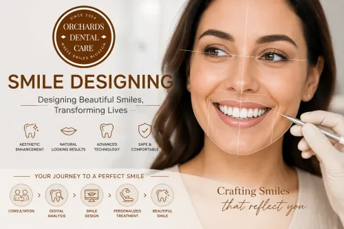 Smile Designing service image