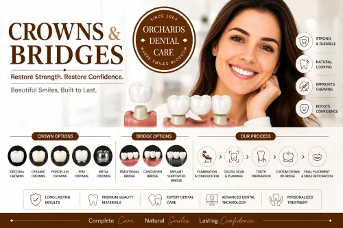 Crowns & Bridges service image