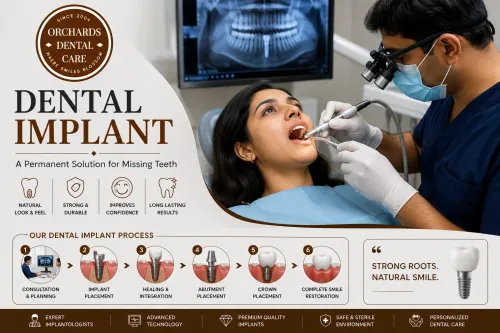 Dental Implants service image