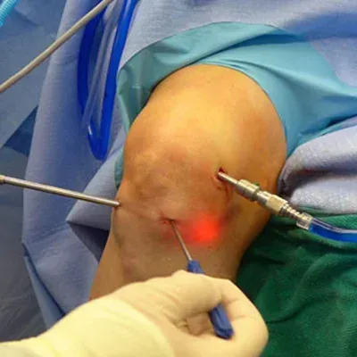 Arthroscopy service image