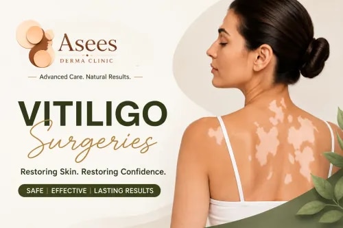 Vitiligo Surgeries service image