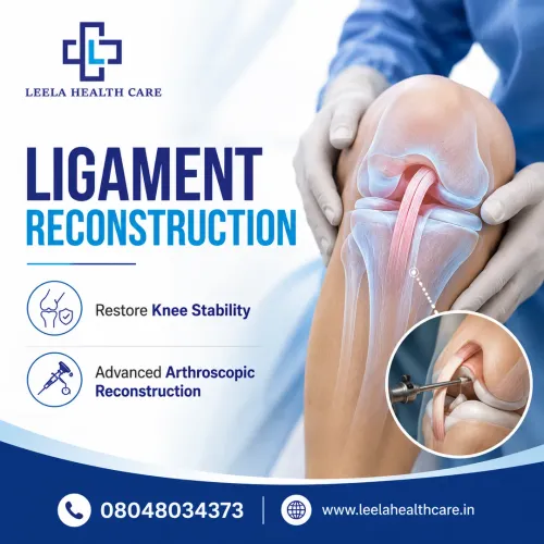 Ligament Reconstruction service image