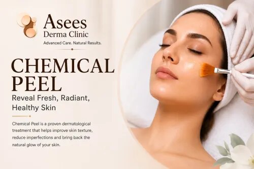 Chemical Peel service image