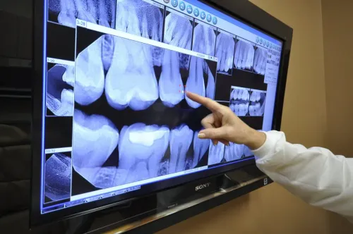 Digital Dental X-ray service image