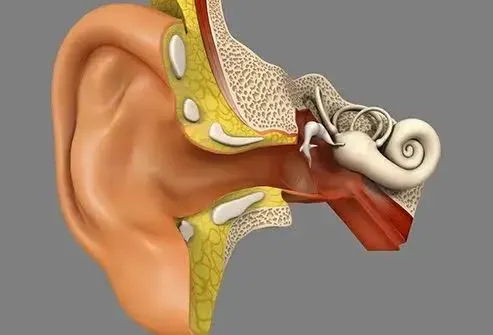 Stapedectomy service image