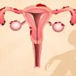 Endometriosis service image