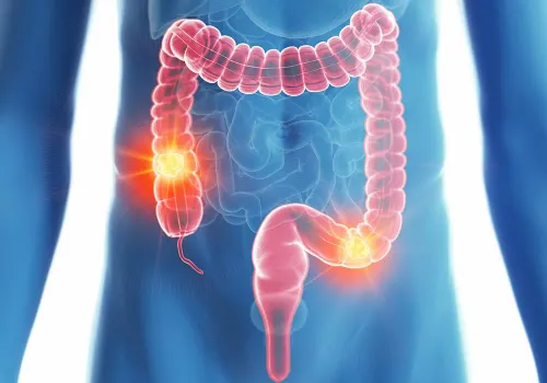 Coloproctology  service image