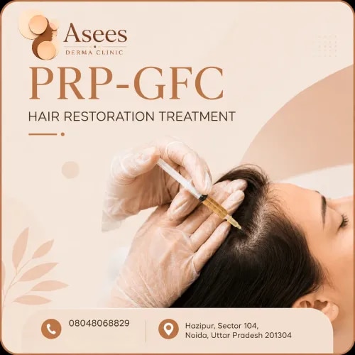 PRP/GFC - Hair Restoration Treatment  service image