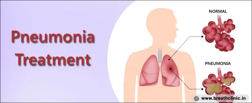 Pneumonia Treatment – Dr. Sanjay Gabhale, Chest Clinic Moshi service image
