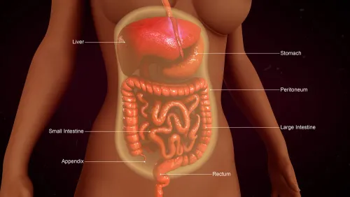 Peritoneal Surface Malignancies  service image