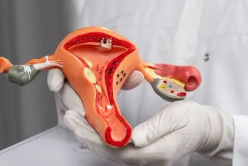 Ovarian Cyst Treatment Specialist in Ambegaon, Narhe, Dhayari  service image