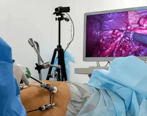 Bariatric / Weight Loss Surgery service image