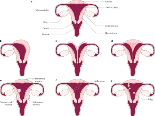 Recurrent Miscarriage Treatment service image