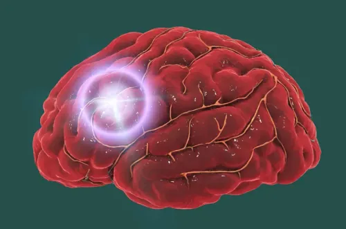 Stroke service image