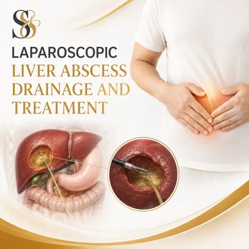 Laparoscopic Liver Abscess Drainage and Treatment service image