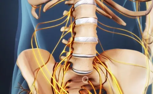 Sciatica service image