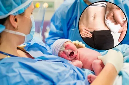 Normal and Caesarean Delivery Care service image