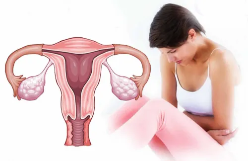 Irregular Periods and Abnormal Uterine Bleeding service image