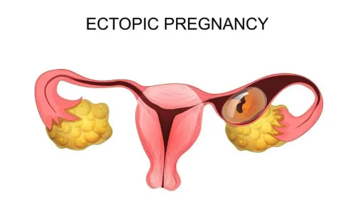 Ectopic Pregnancy Management service image
