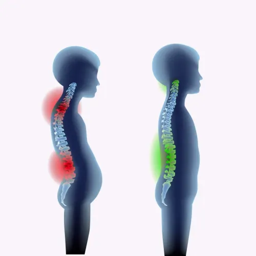 Scoliosis service image