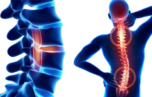 Spinal Deformity Correction service image