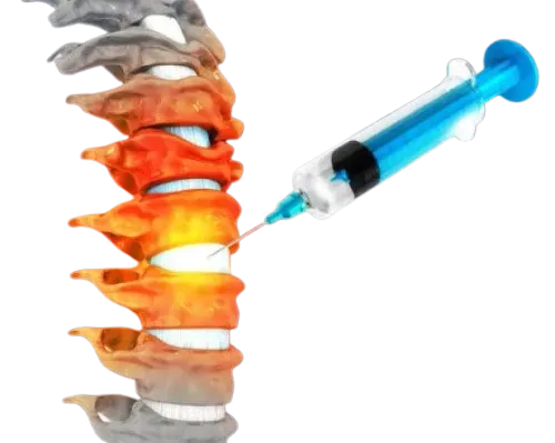 Spine Injection service image