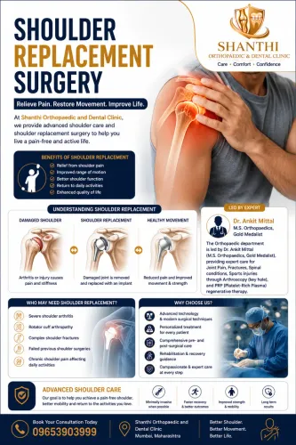Shoulder replacement surgery service image