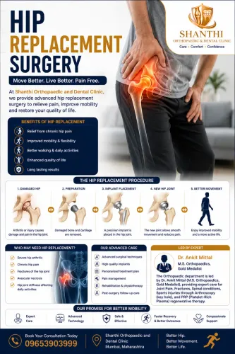 Hip replacement surgery service image