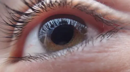 Cataract Surgery service image