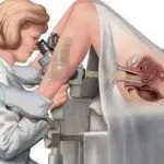 Colposcopy service image