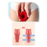 Laser Vaginal Tightening service image
