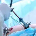 Laparoscopy and Hysteroscopy  in dhanori  service image