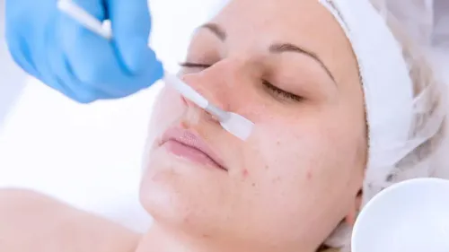 Chemical Peel Treatment service image