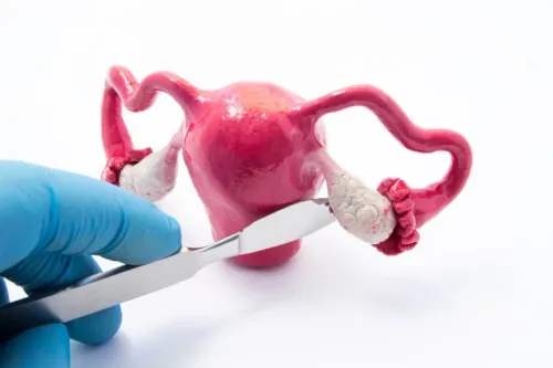 Cystectomy Procedure service image