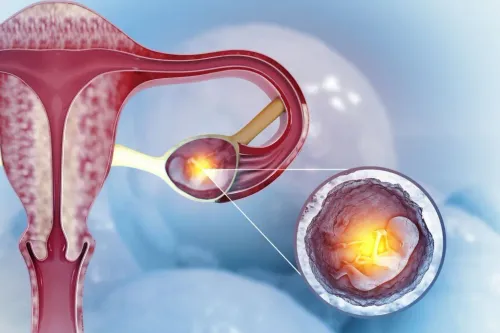 Ectopic Pregnancy Treatment service image