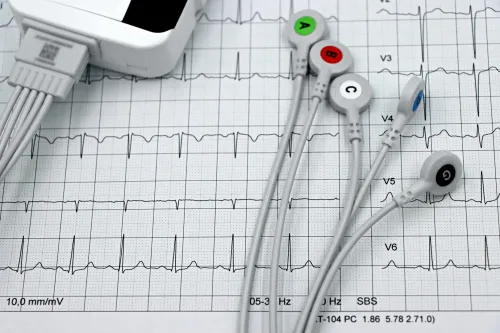 ECG (Electrocardiogram) service image