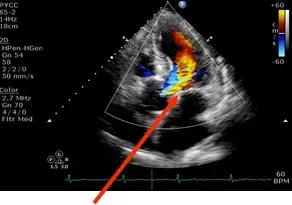2D Echocardiography & Colour Doppler (Echo) service image