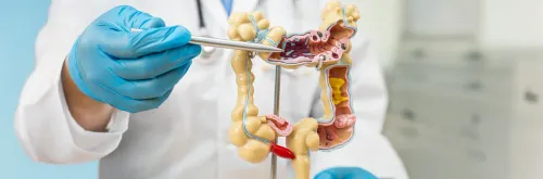 Colorectal Oncology service image