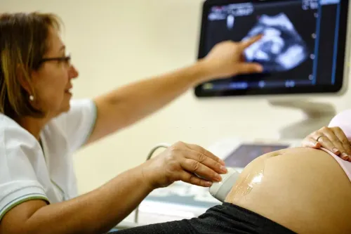 Prenatal Scan service image