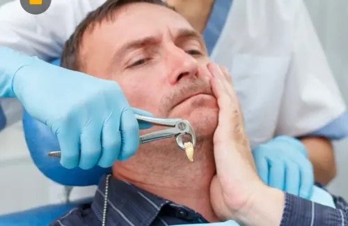 Tooth Extraction service image