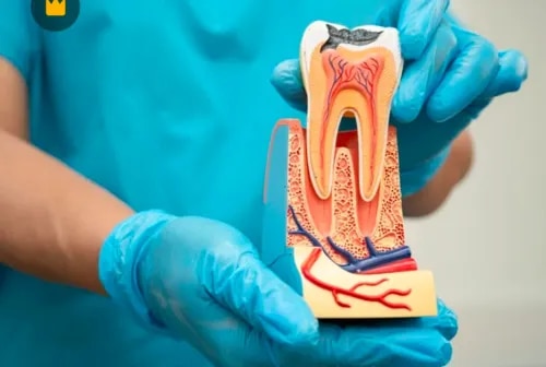 Root Canal Treatment  service image