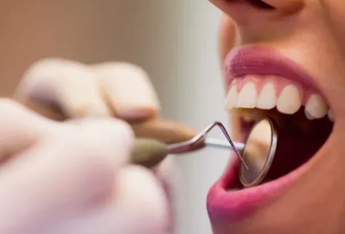 Dental Check-Up service image