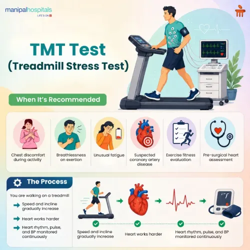 Stress Test (TMT) service image