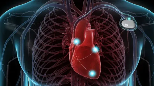 ICD Implantation  service image