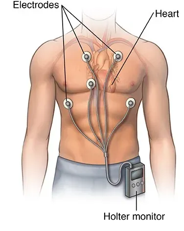Holter Moniter service image