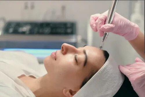 Microdermabrasion Specialist in Nashik service image